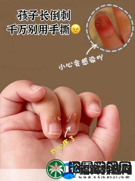 宝宝怎么才三根手指就痛